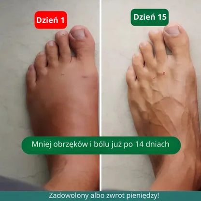 Zenstride® Oddychające skarpetki uciskowe na nogi i stopy bez bólu