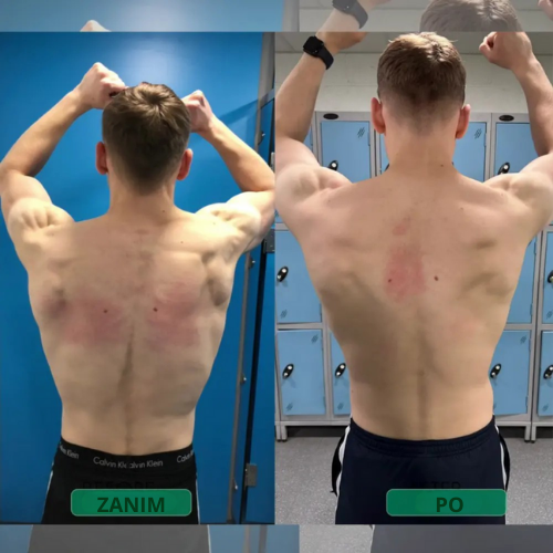 Korektor Postawy – Stój prosto. Odciąż plecy. Poczuj różnicę już od pierwszego dnia.