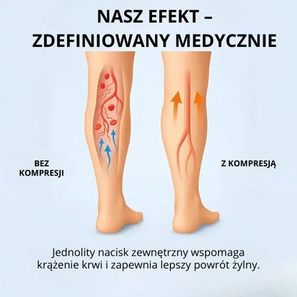 Zenstride® Oddychające skarpetki uciskowe na nogi i stopy bez bólu